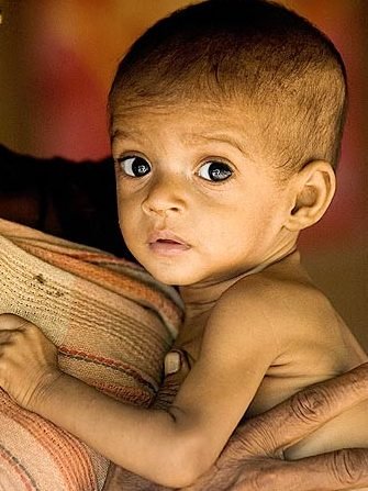 NITI AAYOG TO EXAMINE EMERGING DATA ON UNDER-NUTRITION